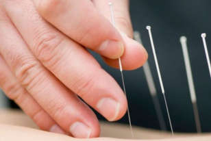 utensilios de acupuntura